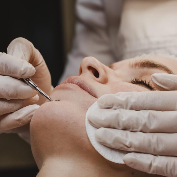 Esthetician Must-Have: Top Extraction Supply Revealed